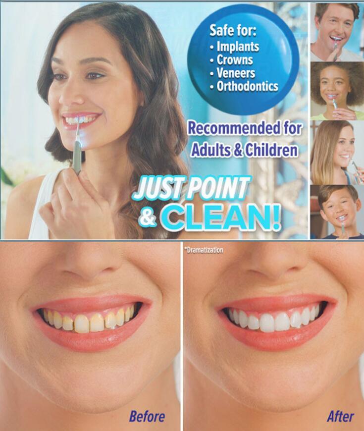Nettoyant Dentaire Professionnel pour un Blanchiment Éclatant