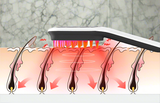Lumicap Pro™ - 6-in-1 Therapeutic Comb
 Photonic Stimulation • Biomagnetism • Anti-Hair Loss Treatment