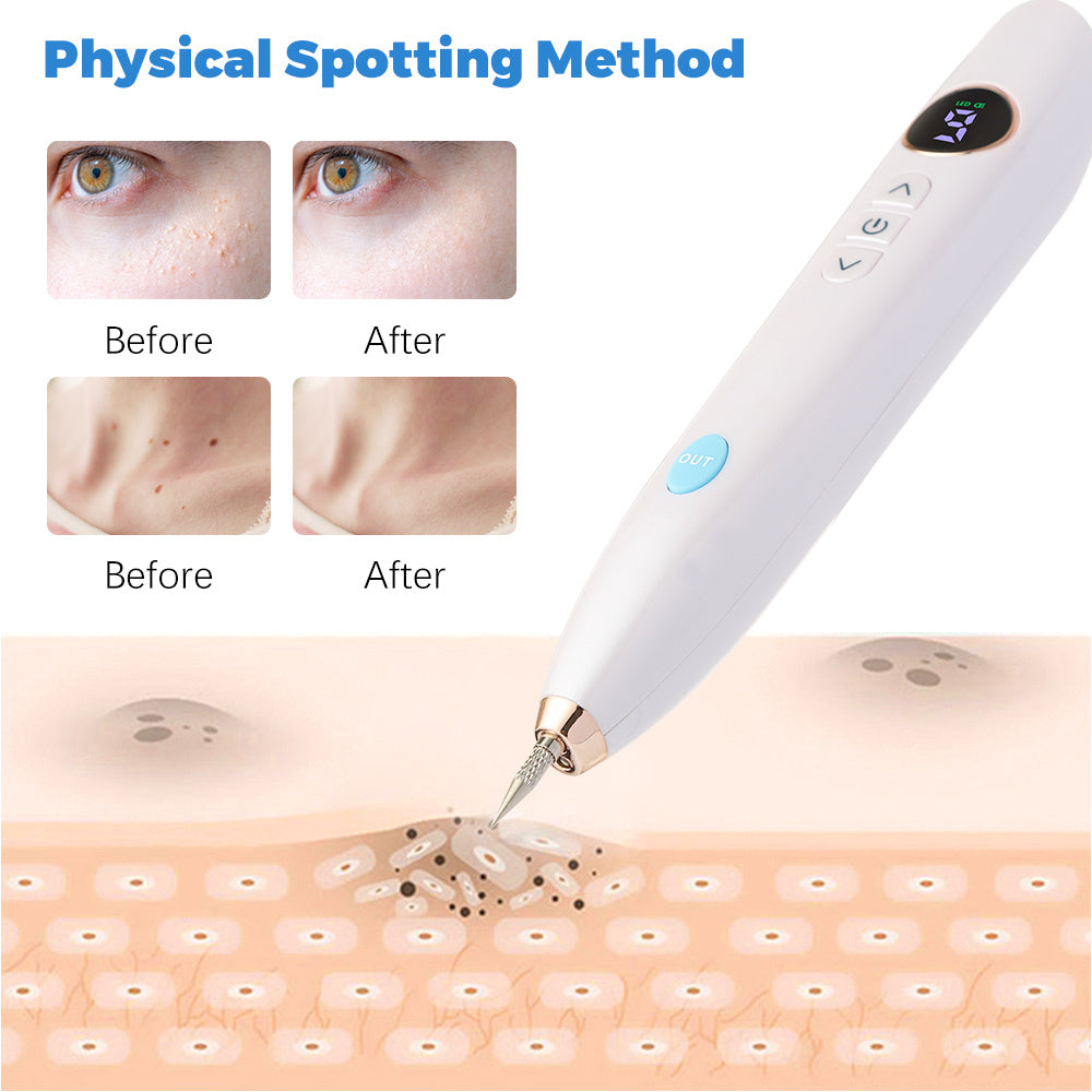 Stylo Plasma Professionnel – Élimination des Peaux Mortes, Grains de Beauté et Taches